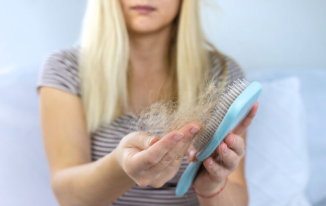 Hair Thinning